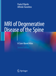 MRI of Degenerative Disease of the Spine A Case-Based Atlas 2nd ed 2021 Edition