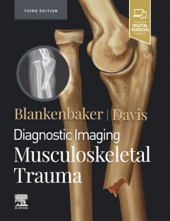 Diagnostic Imaging Musculoskeletal Trauma 3rd Edition