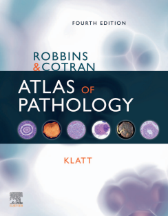 Robbins_and_Cotran_Atlas_of_Pathology_Robbins_Pathology