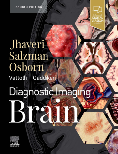 Diagnostic Imaging Brain 4th Edition 2 vol