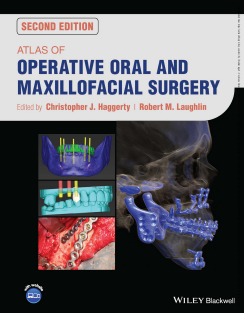 Atlas of Operative Oral and Maxillofacial Surgery 1st Edition