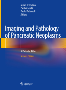 Imaging and Pathology of Pancreatic Neoplasms A Pictorial Atlas 2023