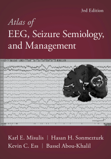 Atlas of EEG, Seizure Semiology, and Management 3rd Edition