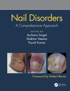 Nail Disorders- A Comprehensive Approach - Archana Singal
