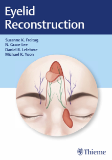 Eyelid Reconstruction 1st Edition