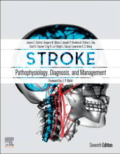 Stroke Pathophysiology, Diagnosis, and Management by Grotta