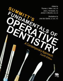 summitt s fundamentals of operative dentistry