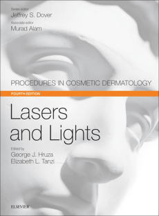 Lasers and Lights Procedures in Cosmetic Dermatology Series, 4e