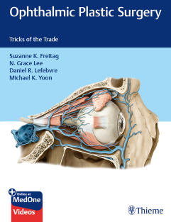 Ophthalmic_Plastic_Surgery_Tricks_of_the_Trade_By_Suzanne_Freitag