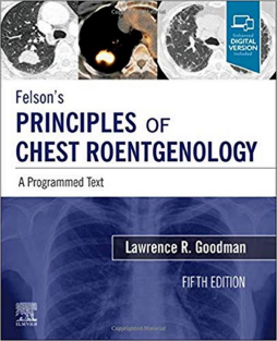 Felson's Principles of Chest Roentgenology 5e